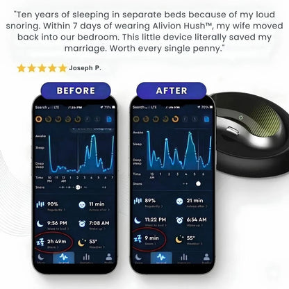 Alivion Hush™ EMS Anti-Snoring Device AlivionLab